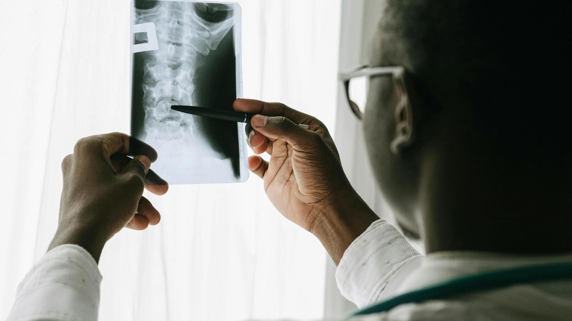 Lower Back Pain: When Should You Get an X-Ray (And When It’s a Waste of Time)