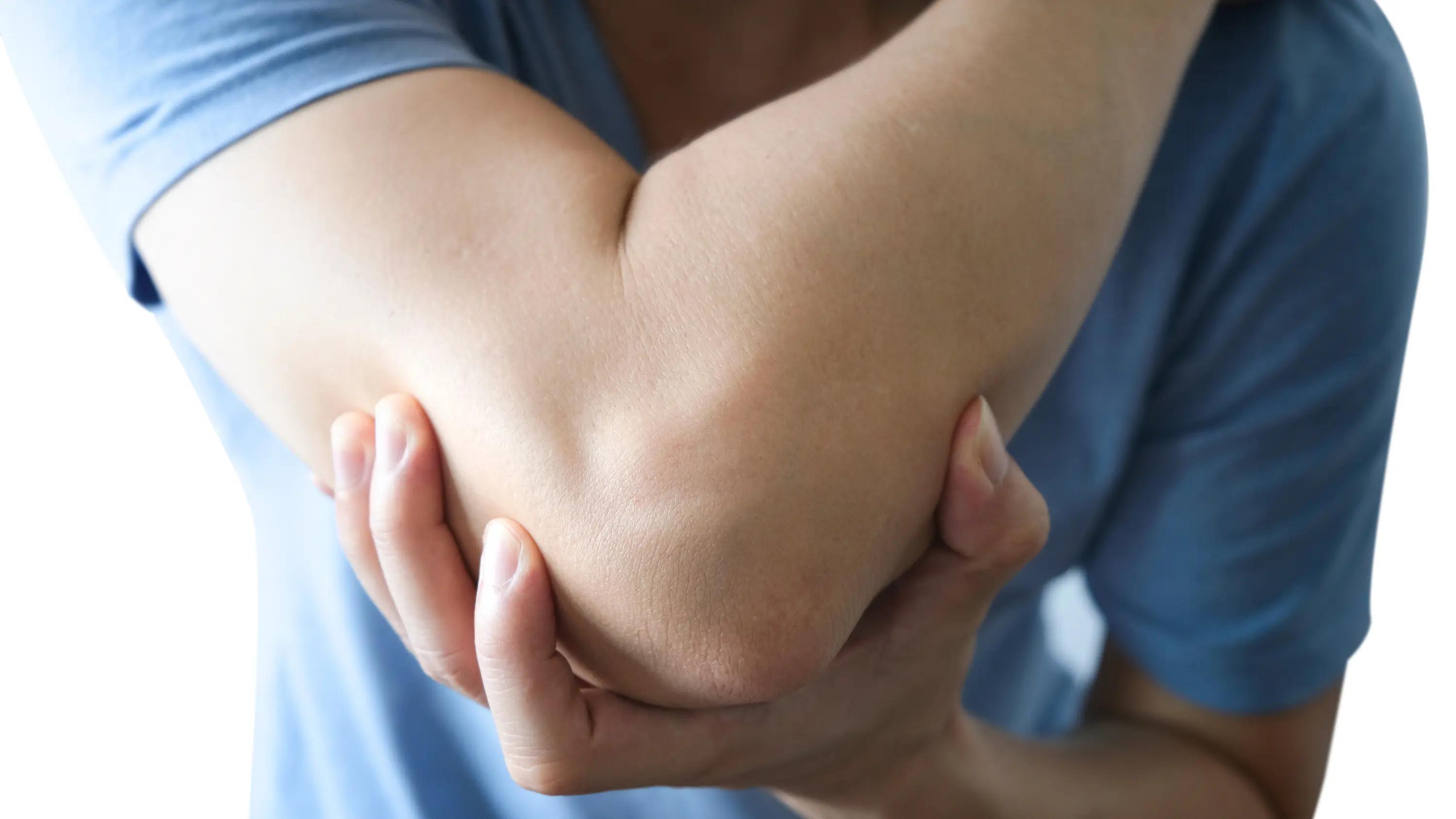 Triceps Tendonitis: Why Your Arm Pain Isn’t Going Away