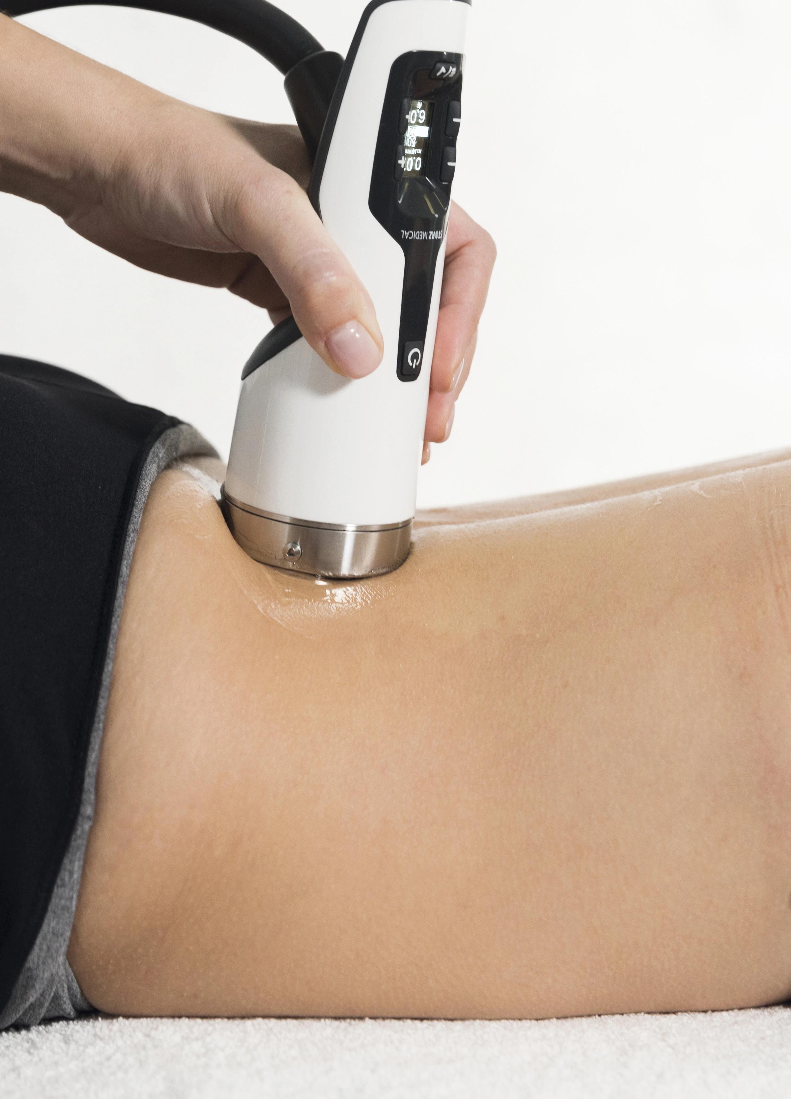 The Science Behind Shockwave Therapy for Lower Back Pain: A Comprehensive Evidence Review for Unpain Clinic